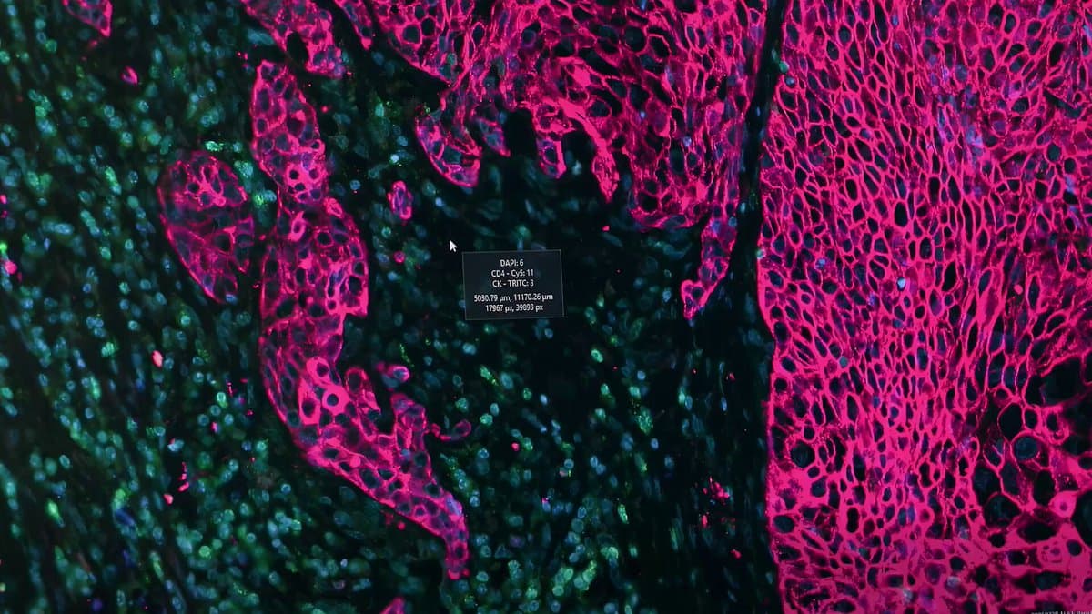 Microsoft's GigaTIME AI Predicts Protein Maps from $5 Tissue Slides, Revealing 1,234 New Survival Correlations